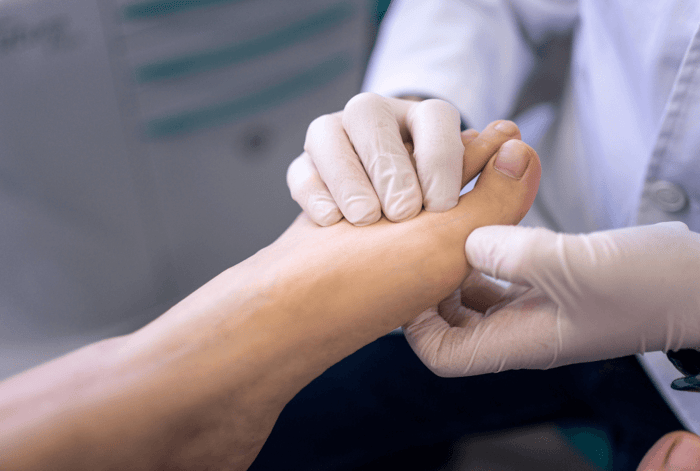 อาการเท้าตก เป็นอาการที่บ่งบอกถึงปัญหาการทำงานของกล้ามเนื้อหรือเส้นประสาทที่ควบคุมการกระดกข้อเท้า แม้อาจไม่ใช่โรคโดยตรง แต่สามารถส่งผลต่อความปลอดภัยและคุณภาพชีวิตอย่างชัดเจน