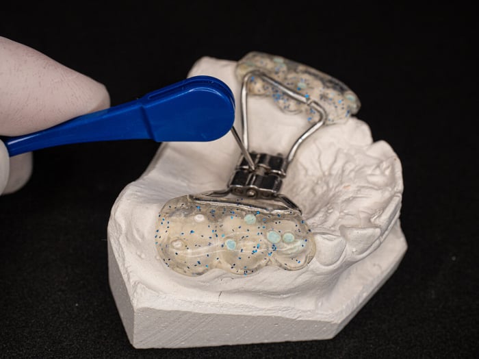 The Top Choice for Palatal Expanders: Dr. Michelle Palmer