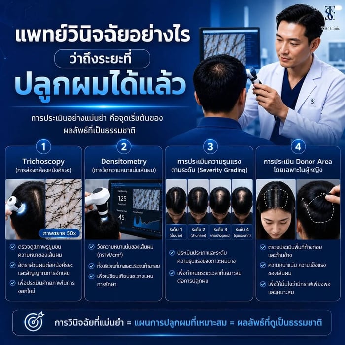 แพทย์วินิจฉัยอย่างไรว่าถึงระยะที่ปลูกผมได้แล้ว