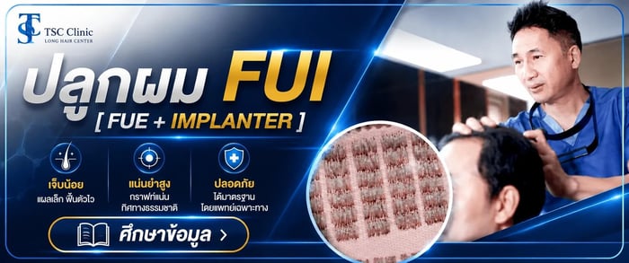 ปลูกผม FUI