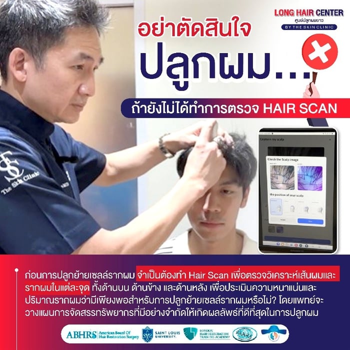 อย่าตัดสินใจปลูกผม ถ้ายังไม่ได้ทำการตรวจ Hair Scan