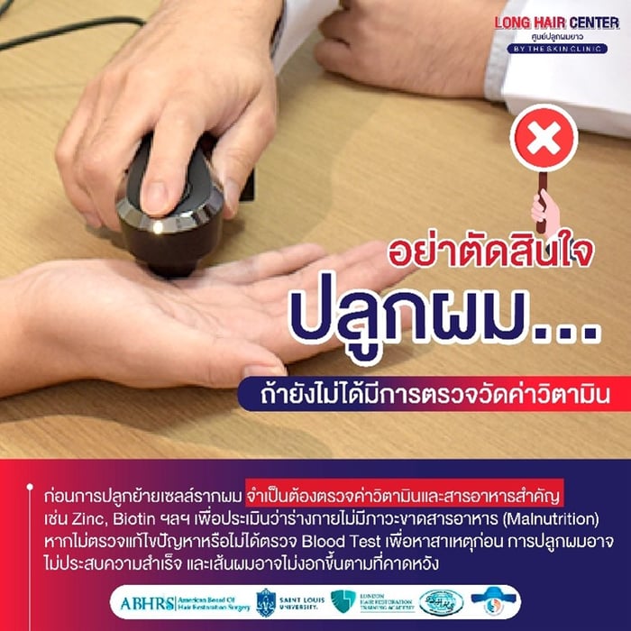 อย่าตัดสินใจปลูกผม ถ้ายังไม่ได้มีการตรวจวัดค่าวิตามิน