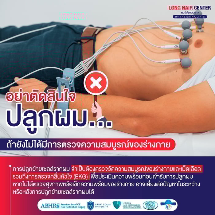 อย่าตัดสินใจปลูกผม ถ้ายังไม่ได้มีการตรวจความสมบูรณ์ของร่างกาย