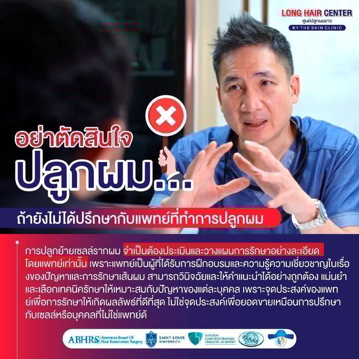 อย่าตัดสินใจปลูกผม ถ้ายังไม่ได้ปรึกษากับแพทย์ที่ทำการปลูกผม