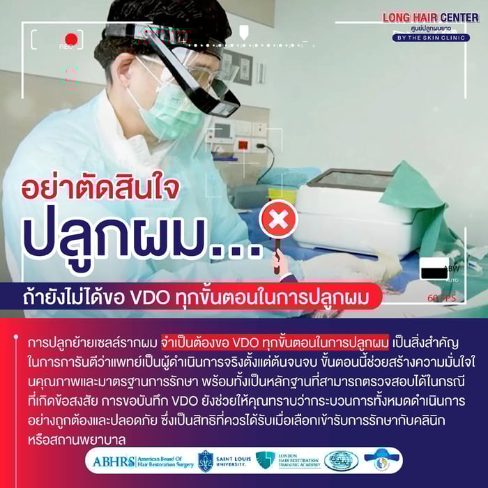 อย่าตัดสินใจปลูกผม ถ้ายังไม่ได้ขอ VDO ทุกขั้นตอนในการปลูกผม