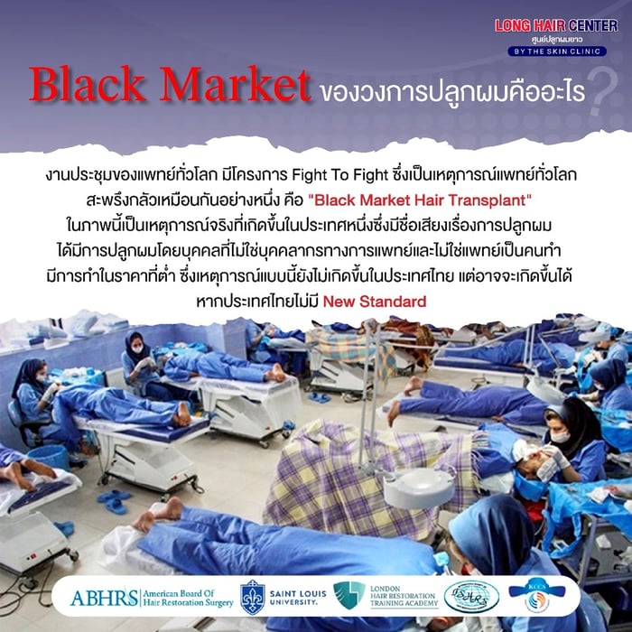 Black Market คืออะไร? คลินิกเถื่อนในต่างประเทศมีอยู่จริงหรือไม่?