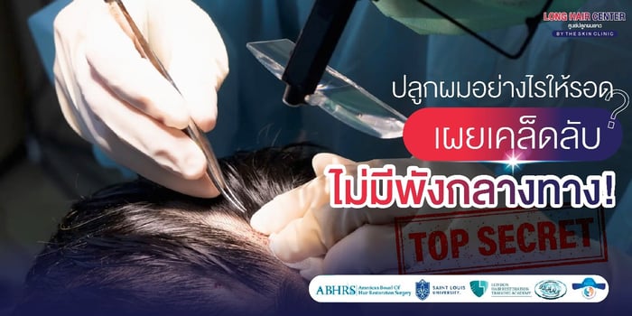 วิธีหลีกเลี่ยงคลินิกปลูกผมเถื่อน