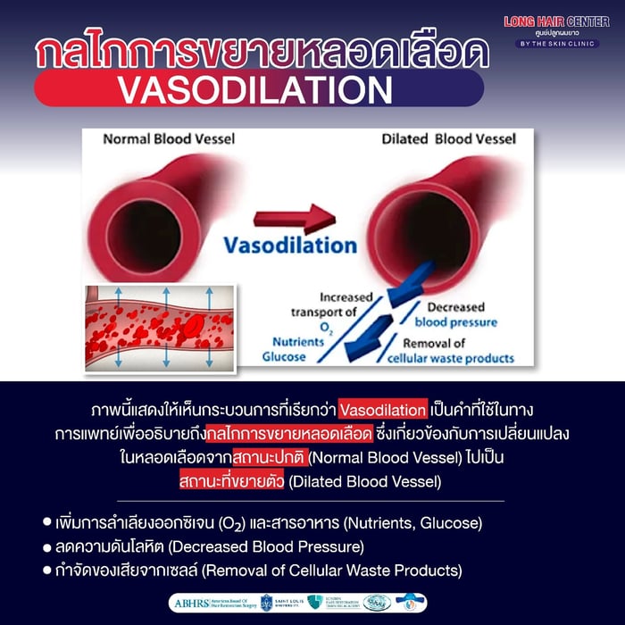 ใช้ Minoxidil ความเข้มข้นเท่าไหร่ดี?