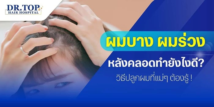 ผมบาง ผมร่วงหลังคลอดทำยังไงดี? วิธีปลูกผมที่แม่ๆ ต้องรู้ !