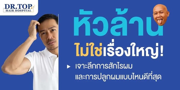 หัวล้านไม่ใช่เรื่องใหญ่! เจาะลึกการสักไรผม และการปลูกผมแบบไหนดีที่สุด