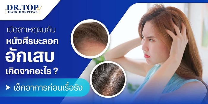 เปิดสาเหตุผมคัน หนังศีรษะลอก อักเสบ เกิดจากอะไร ? เช็กอาการก่อนเรื้อรัง