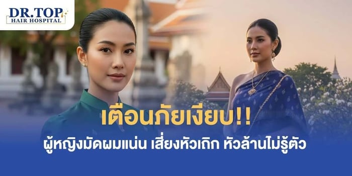 เตือนภัยเงียบ!! ผู้หญิงมัดผมแน่น เสี่ยงหัวเถิก หัวล้านไม่รู้ตัว