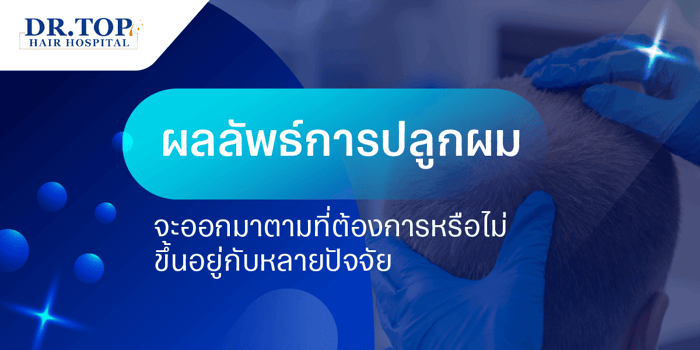 ผลลัพธ์การปลูกผม