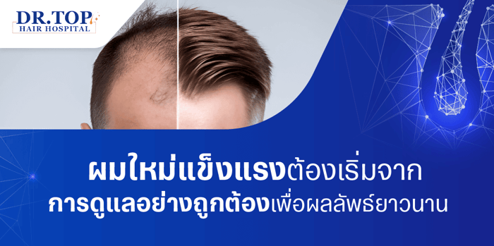 ผมใหม่แข็งแรงต้องเริ่มจากการดูแลอย่างถูกต้อง