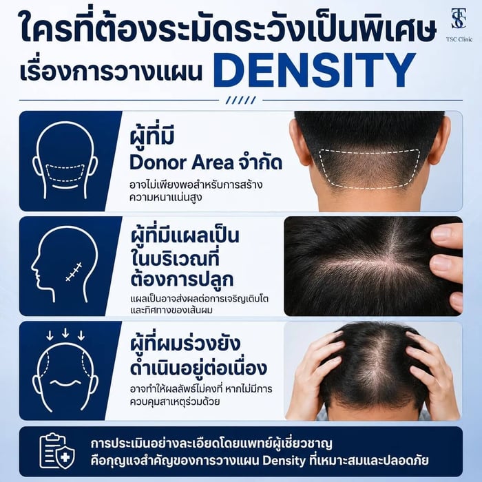 ใครที่ต้องระมัดระวังเป็นพิเศษเรื่องการวางแผน Density