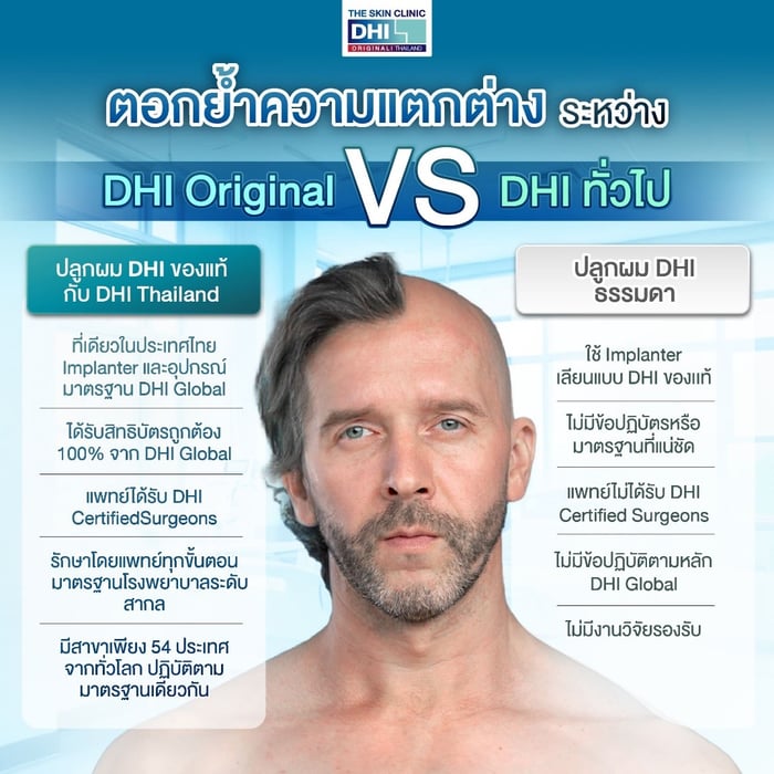 ความแตกต่างระหว่าง DHI Original VS DHI ธรรมดาทั่วไป