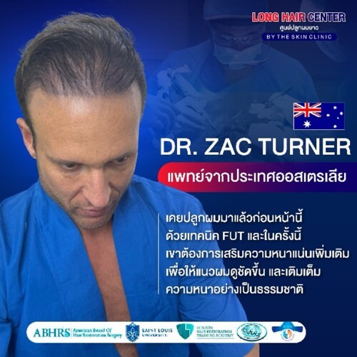 เพราะปัญหาเส้นผมคือเรื่องใหญ่ แม้แต่แพทย์ยังเลือกบินข้ามทวีปมาให้หมอท๊อปดูแล อย่างเคสของ Dr. Zac Turner หนึ่งในแพทย์ที่ไว้วางใจให้หมอท๊อปปลูกผม ตัดสินใจเดินทางจากออสเตรเลียมายัง The Skin Clinic ในเมืองไทย