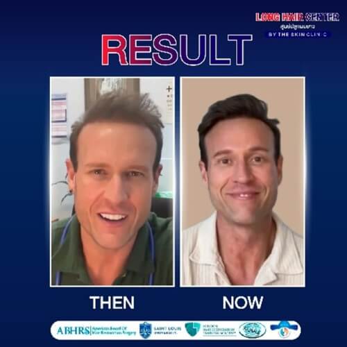 Dr. Zac เคยฟังบรรยายของคุณหมอท๊อปในต่างประเทศ และรู้ว่าหมอท๊อปเป็นหนึ่งในผู้เชี่ยวชาญที่พูดเรื่องนี้ในงานประชุมวิชาการทางการแพทย์ระดับนานาชาติ