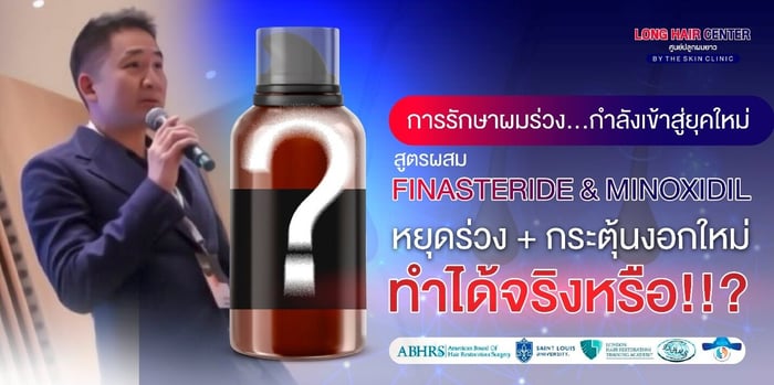 Finasteride แบบทา vs แบบกิน