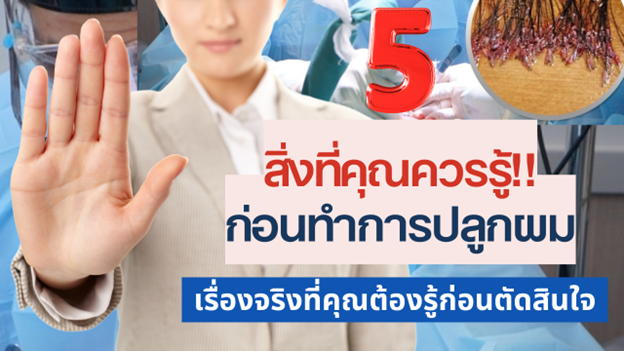 5 สิ่งที่คุณควรรู้ก่อนทำการปลูกผมถาวร ที่ต้องรู้ก่อนตัดสินใจ!