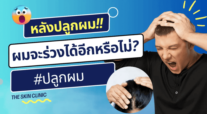 ปลูกผมไปแล้วผมร่วงได้อีกไหม? พร้อมเคล็ดลับดูแลผมหลังปลูก