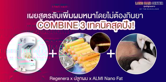 เผยสูตรลับเพิ่มผมหนาโดยไม่ต้องกินยาด้วย 3 เทคนิคสุดปัง! Regenera Activa x ปลูกผม x ALMI Nano Fat
