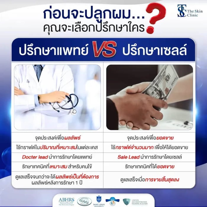 ก่อนปลูกผม ปรึกษาแพทย์ vs พนักงานขาย ใครให้ข้อมูลดีกว่า?
