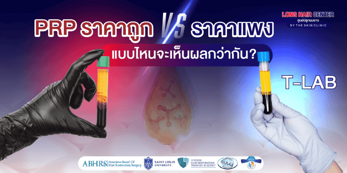 PRP ราคาถูก vs PRP ราคาแพง แบบไหนเห็นผลดีกว่ากัน?