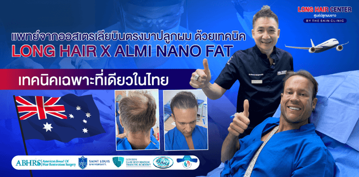 เคสจริง! แพทย์จากออสเตรเลียบินตรงมาปลูกผมกับหมอท๊อป ด้วยเทคนิค Long Hair x ALMI Nano Fat