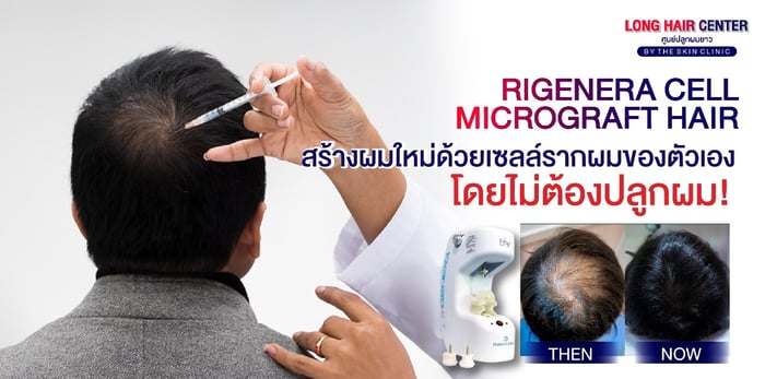 dr-top-hair-hospital-was-a-keynote-speaker-at-a world-renowned-hair-transplant