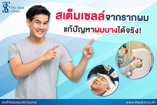 STAM CELL จาก “รากผม”