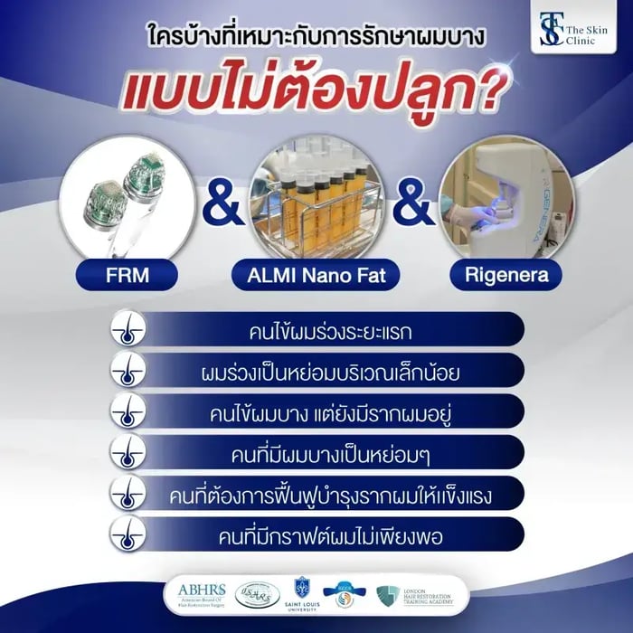 5 ความจริงที่คลินิกปลูกผมอาจไม่ได้บอกคุณ