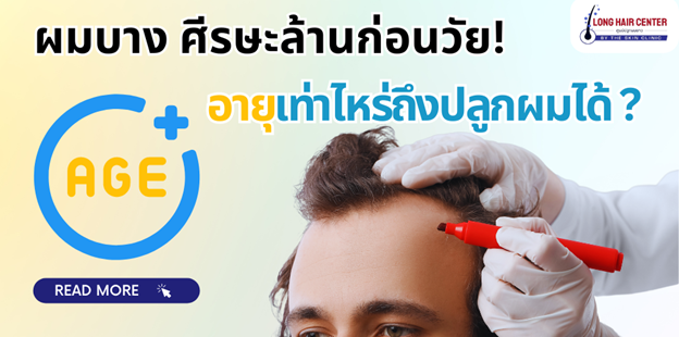 ผมบาง ศีรษะล้านก่อนวัย อายุเท่าไหร่ถึงปลูกผมได้ ?
