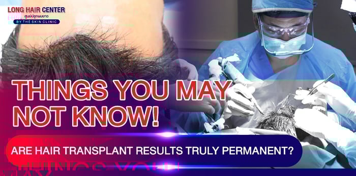 Hair Transplant Aftercare: Do You Need Minoxidil or Finasteride?