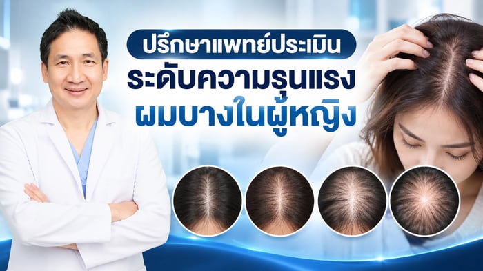 ปรึกษาแพทย์ประเมินระดับความรุนแรงผมบาง