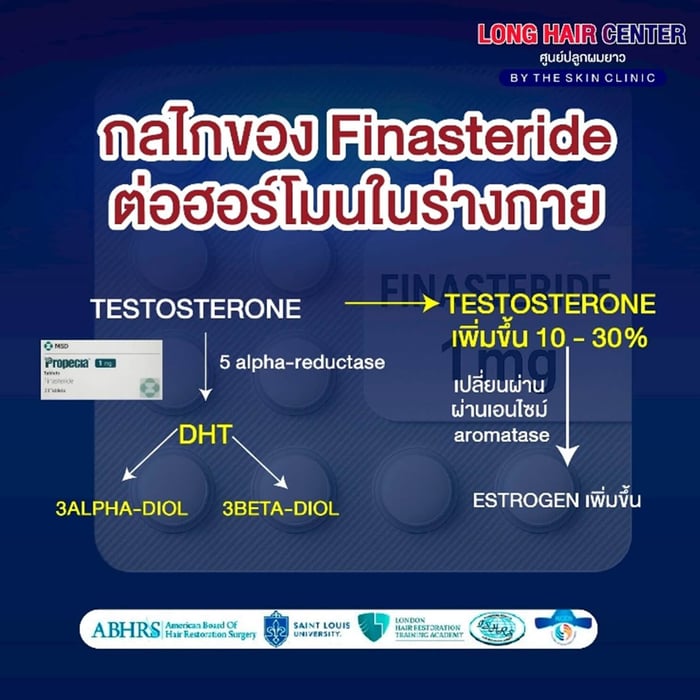 การยับยั้งฮอร์โมน DHT เป็นหัวใจสำคัญในการรักษาผมบางด้วย Finasteride ซึ่งทำหน้าที่ในการยับยั้งเอนไซม์ 5-alpha reductase ที่เปลี่ยนฮอร์โมน Testosterone (ฮอร์โมนเพศชาย)