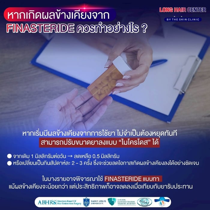 หากเริ่มมีผลข้างเคียงจากการใช้ยา Finasteride ไม่จำเป็นต้องหยุดทันที แต่สามารถปรับขนาดยาลงแบบ “ไมโครโดส” ได้ เช่น จากเดิม 1 มิลลิกรัมต่อวัน ลดเหลือ 0.5 มิลลิกรัม หรือเปลี่ยนเป็นกินสัปดาห์ละ 2 – 3 ครั้ง