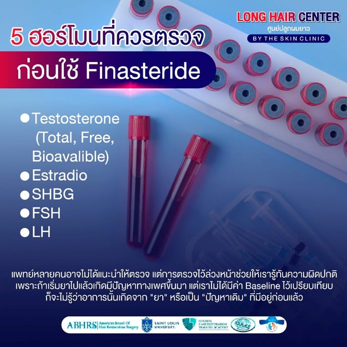 ก่อนใช้ Finasteride แนะนำให้ตรวจ 5 ฮอร์โมน คือ Testosterone, Estradiol, SHBG, FSH และ LH ล้วนเป็นฮอร์โมนสำคัญที่เกี่ยวข้องกับระบบสืบพันธุ์และสมดุลของร่างกาย