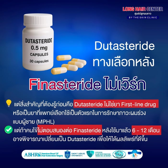 Dutasteride ทางเลือกหลัง Finasteride ไม่เวิร์ก