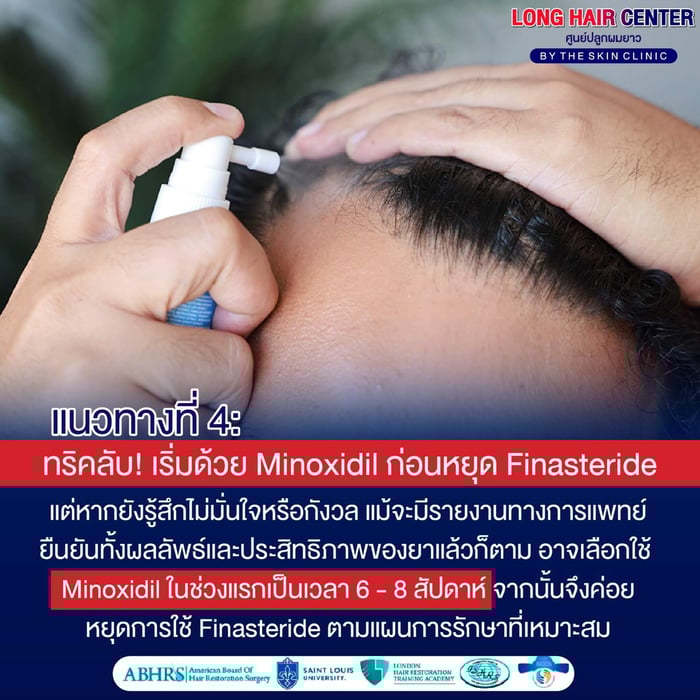 หากยังรู้สึกไม่มั่นใจหรือกังวล แม้จะมีรายงานทางการแพทย์ยืนยันทั้งผลลัพธ์ และประสิทธิภาพของยาแล้วก็ตาม ก่อนหยุดยา Finasteride อาจเลือกใช้ Minoxidil ในช่วงแรกเป็นเวลา 6 – 8 สัปดาห์ จากนั้นจึงค่อยหยุดการใช้ Finasteride ตามแผนการรักษาที่เหมาะสม