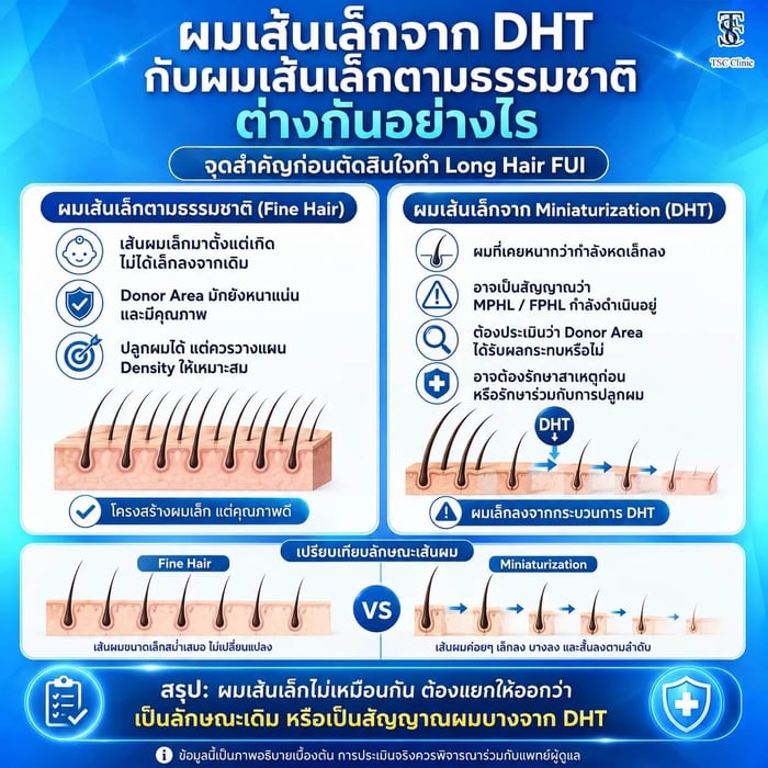การแยกความแตกต่างผมเส้นเล็กตามธรรมชาติกับ Miniaturization จาก DHT