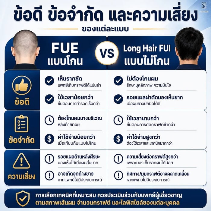 ข้อดี ข้อจำกัด และความเสี่ยงของแต่ละแบบ