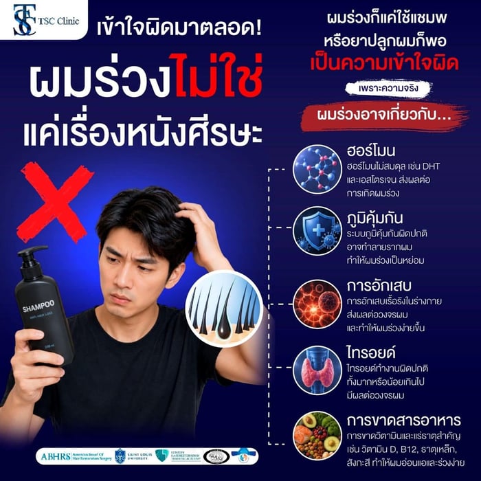 สาเหตุผมร่วง