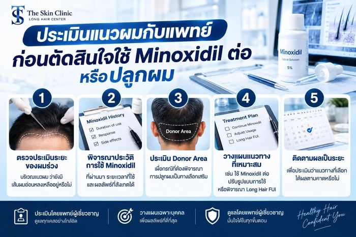แพทย์ประเมินแนวผมก่อนตัดสินใจใช้ Minoxidil ต่อหรือปลูกผมที่ The Skin Clinic