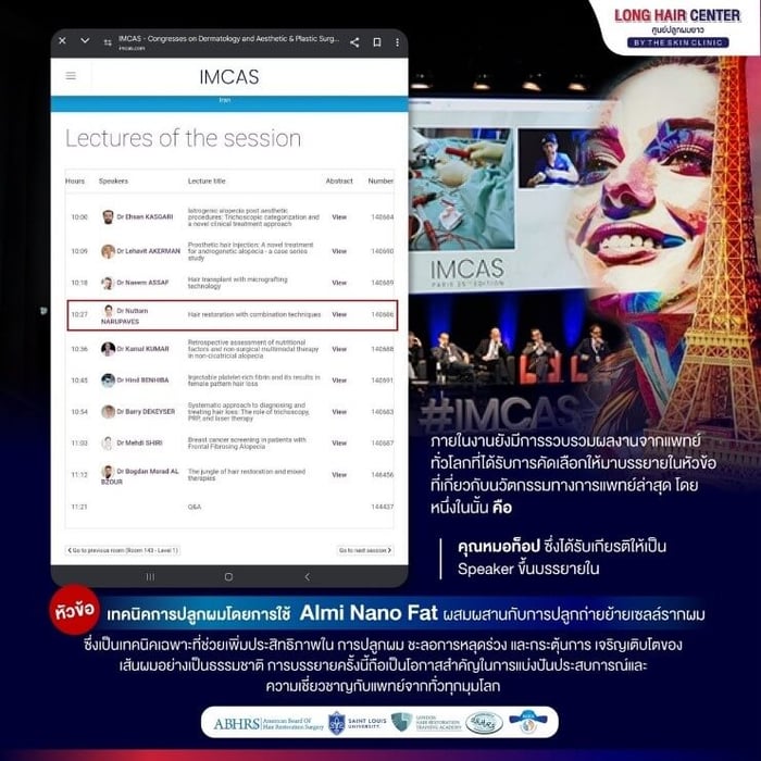 นวัตกรรมด้านการปลูกผม, Hair Transplant