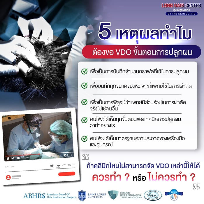 ทำไมต้องขอ VDO ปลูกผม ทุกขั้นตอน?