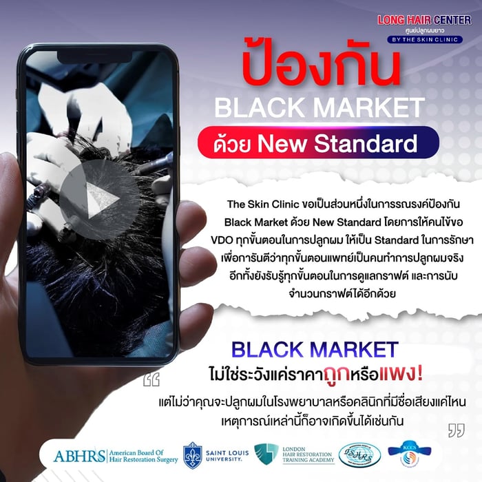 VDO ปลูกผม