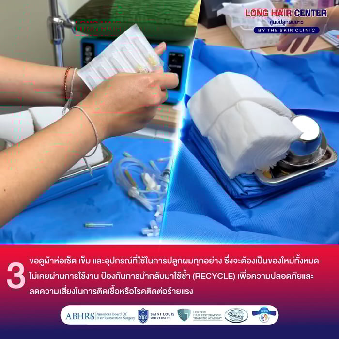 คลินิกปลูกผม, ศัลยกรรมปลูกผม