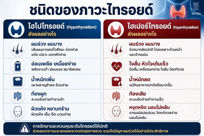 ผลของไฮโปไทรอยด์และไฮเปอร์ไทรอยด์ต่อการปลูกผม