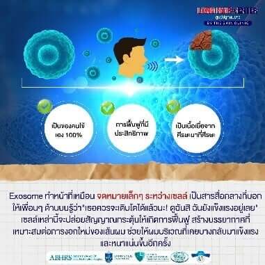 เทคนิค Regenera Micrograft Hair